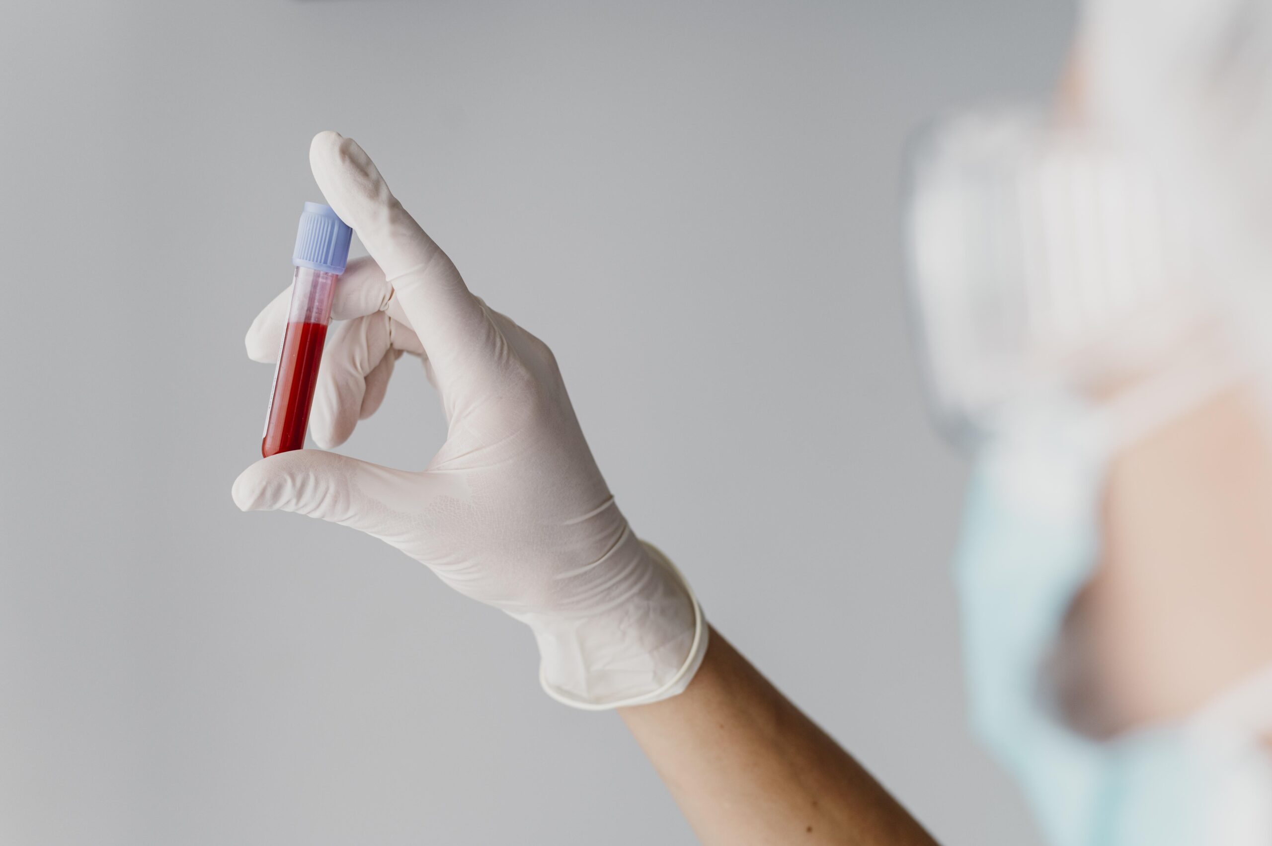 Eigenbluttherapie beim Zahnarzt