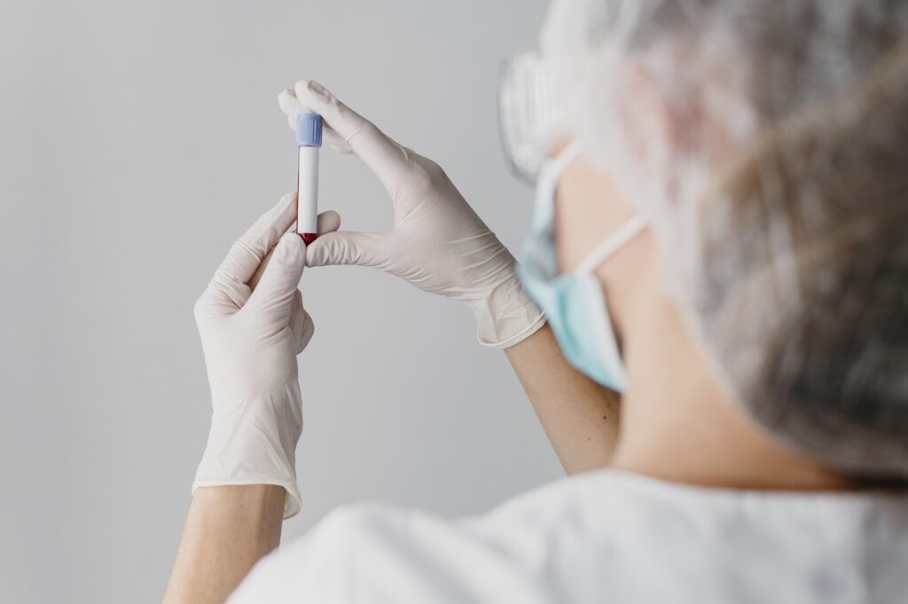 Analyse bei der Eigenbluttherapie